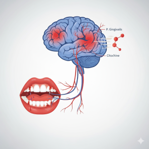malattia parodontale (piorrea) e l'Alzheimer. 